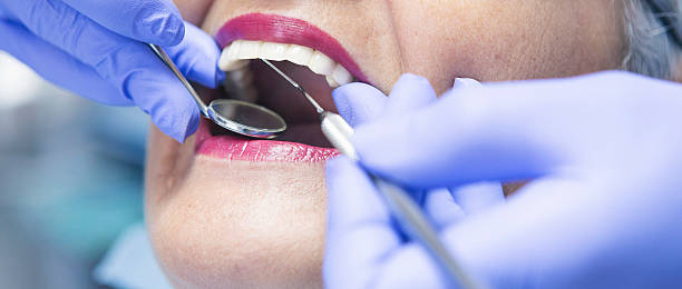 Best Emergency Dentist for Knocked-Out Tooth in Malden, MO